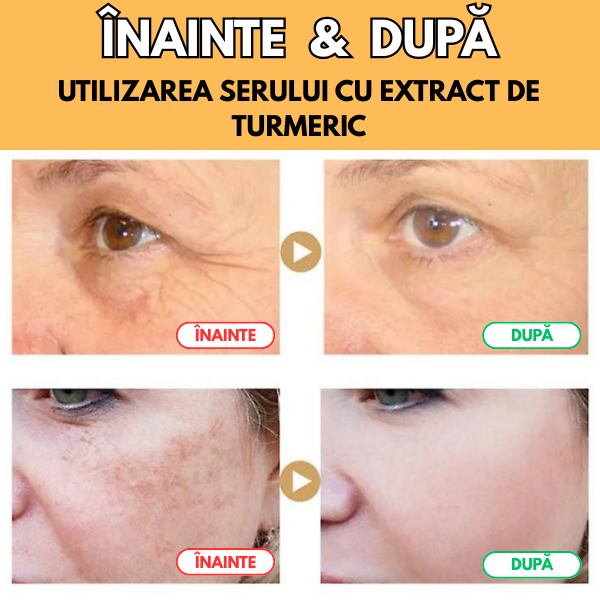 Ser Natural cu Extract de Turmeric pentru Riduri, Pete pigmentare & Acnee