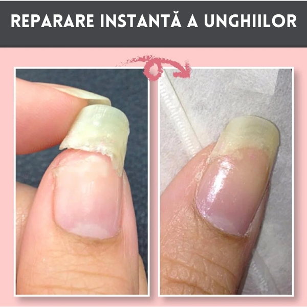 NailRepair™ Gel Pentru Repararea Unghiilor